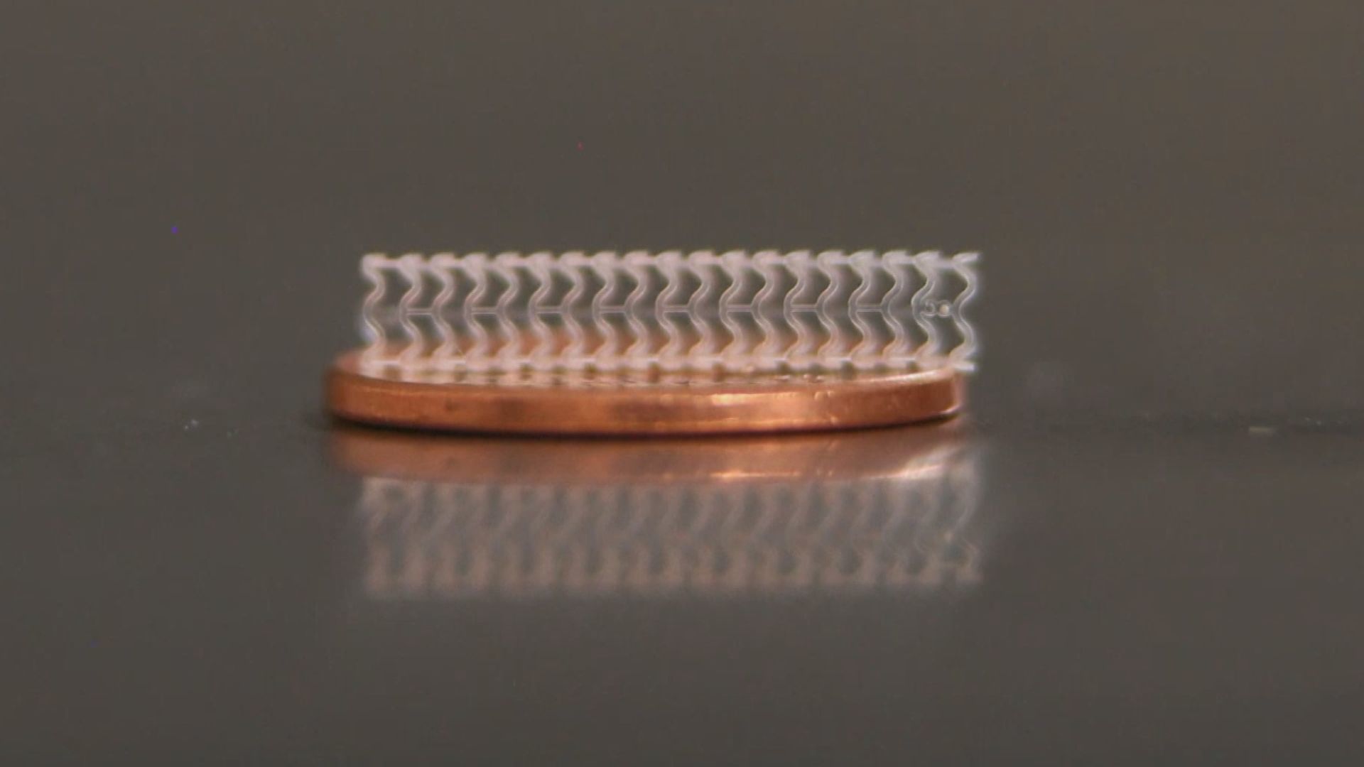 stent